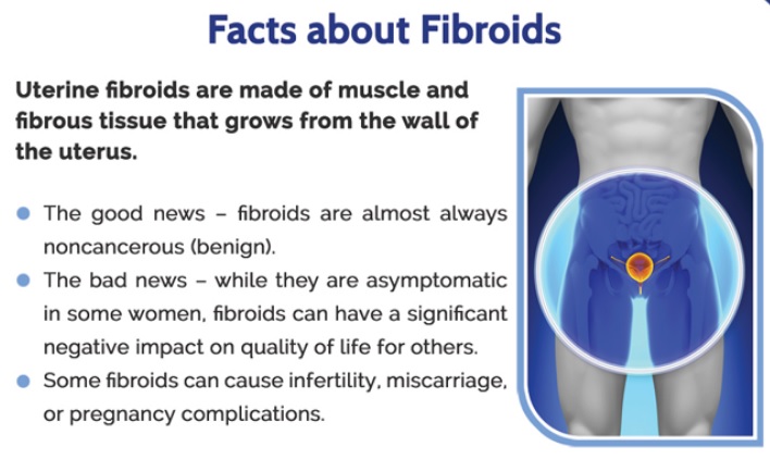 What Everyone Must Know About Fibroids Treatment Near Schererville IN